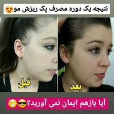 تونیک اورجینال اصل کاهش ریزش مو و محرک سرعت رشد مو تقویت کننده مو ۳۰۰ میل ارسال مستقیم از شرکت ایرانیان زمین