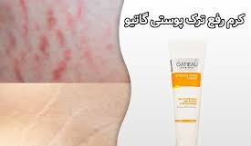 کرم رفع ترک های پوستی تضمینی ناشی از چاقی و لاغری گاتیو ایتالیا 100 میل