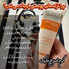 کرم رفع ترک های پوستی تضمینی ناشی از چاقی و لاغری گاتیو ایتالیا 100 میل