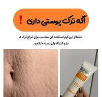 کرم رفع ترک های پوستی تضمینی ناشی از چاقی و لاغری گاتیو ایتالیا 100 میل