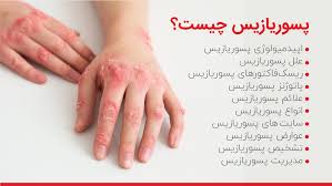 کرم کمک به درمان پسوریازیس ویتامین E و آلوئه ورا ویتابلا اصل ضمانتی مستقیم از شرکت ایرانیان زمین