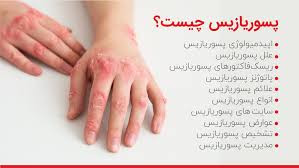 کرم کمک به درمان پسوریازیس ویتامین E و آلوئه ورا ویتابلا اصل ضمانتی مستقیم از شرکت ایرانیان زمین