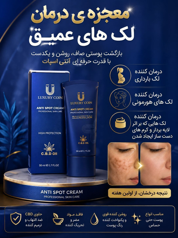 کرم بیوممتیک رفع لک های بارداری و پر رنگ قهوه ای برند لاکچری کوین فرانسه اصل 50میل