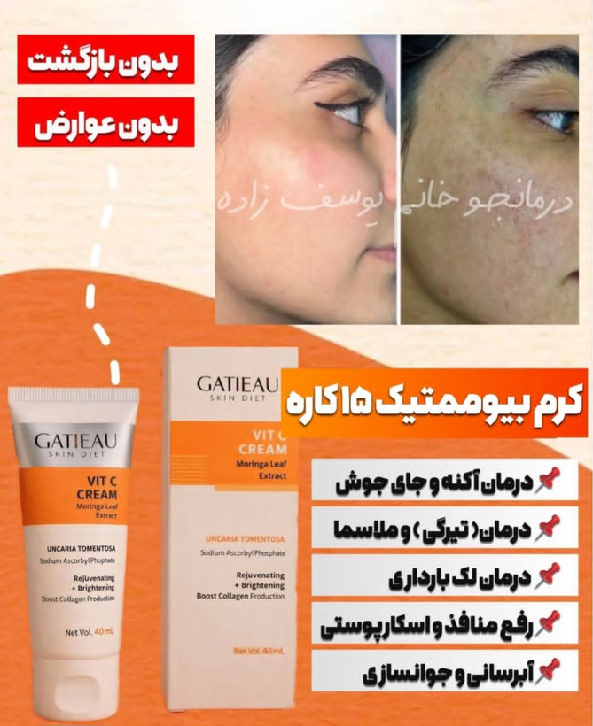 کرم بیوممتیک ضد لک جهانی کلاژن ساز جوانساز گاتیو ایتالیا