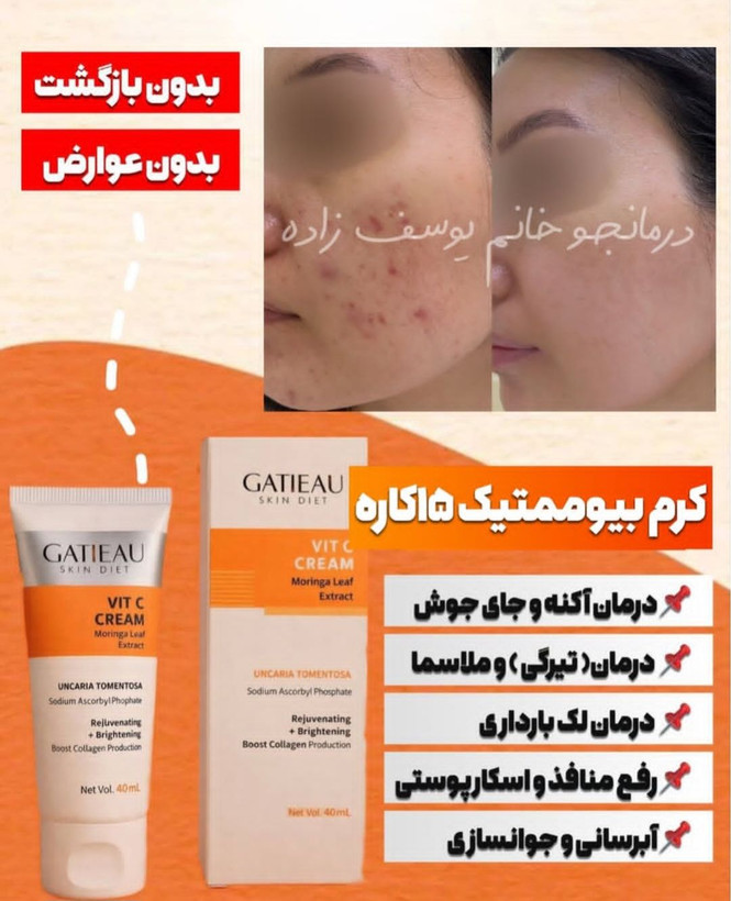 کرم بیوممتیک ضد لک جهانی کلاژن ساز جوانساز گاتیو ایتالیا